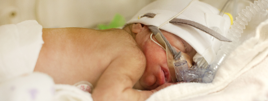 Baby in the NICU.