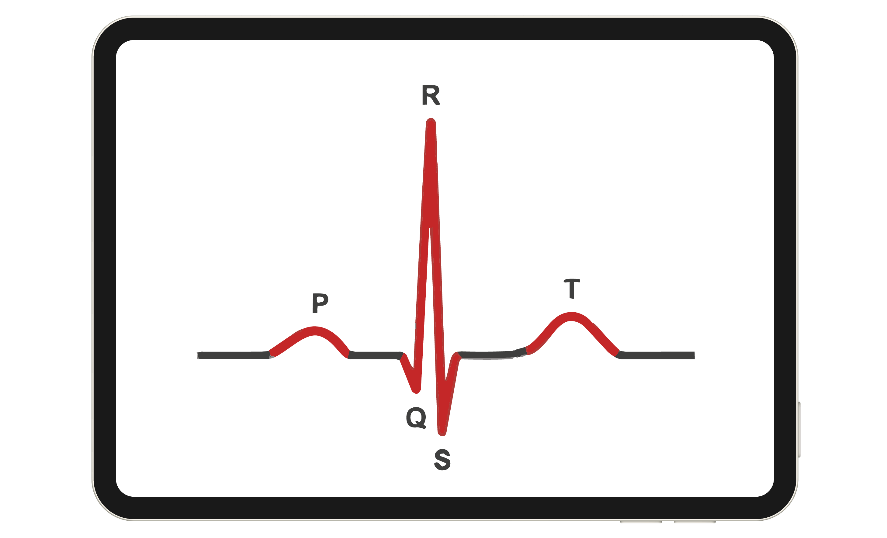 A line graph.
